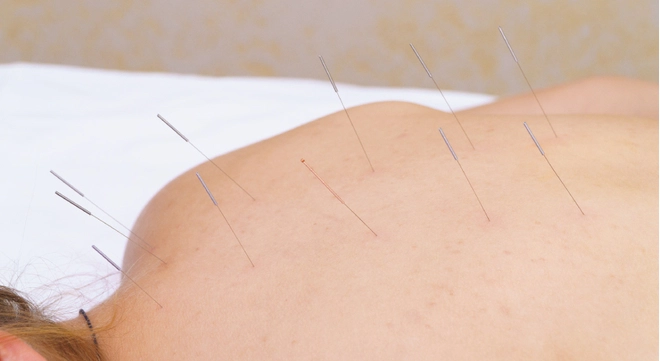 Пансионат &laquo;Урал&raquo;, Анапа, изображение 15