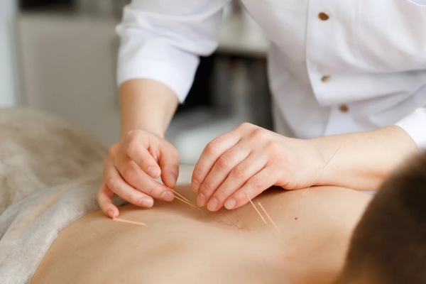 Рефлексотерапия