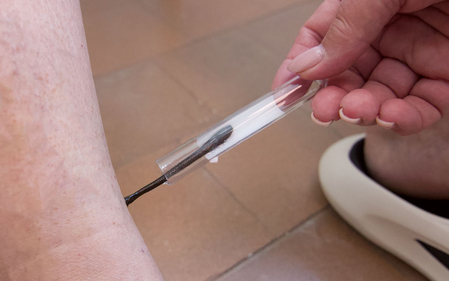 Установка пиявки