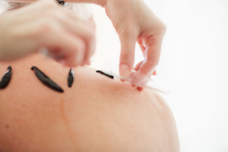 Санаторий «Машук», Пятигорск, изображение 84