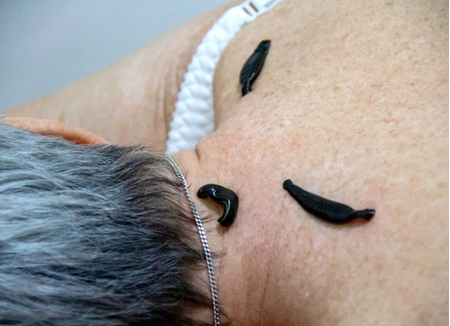 Санаторий «Кирова», Ялта, изображение 11