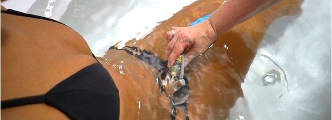 Санаторий «Кирова», Ялта, изображение 16